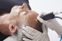 Hydrafacial Keravive Tips Yellow (15 kpl) - pakkaus