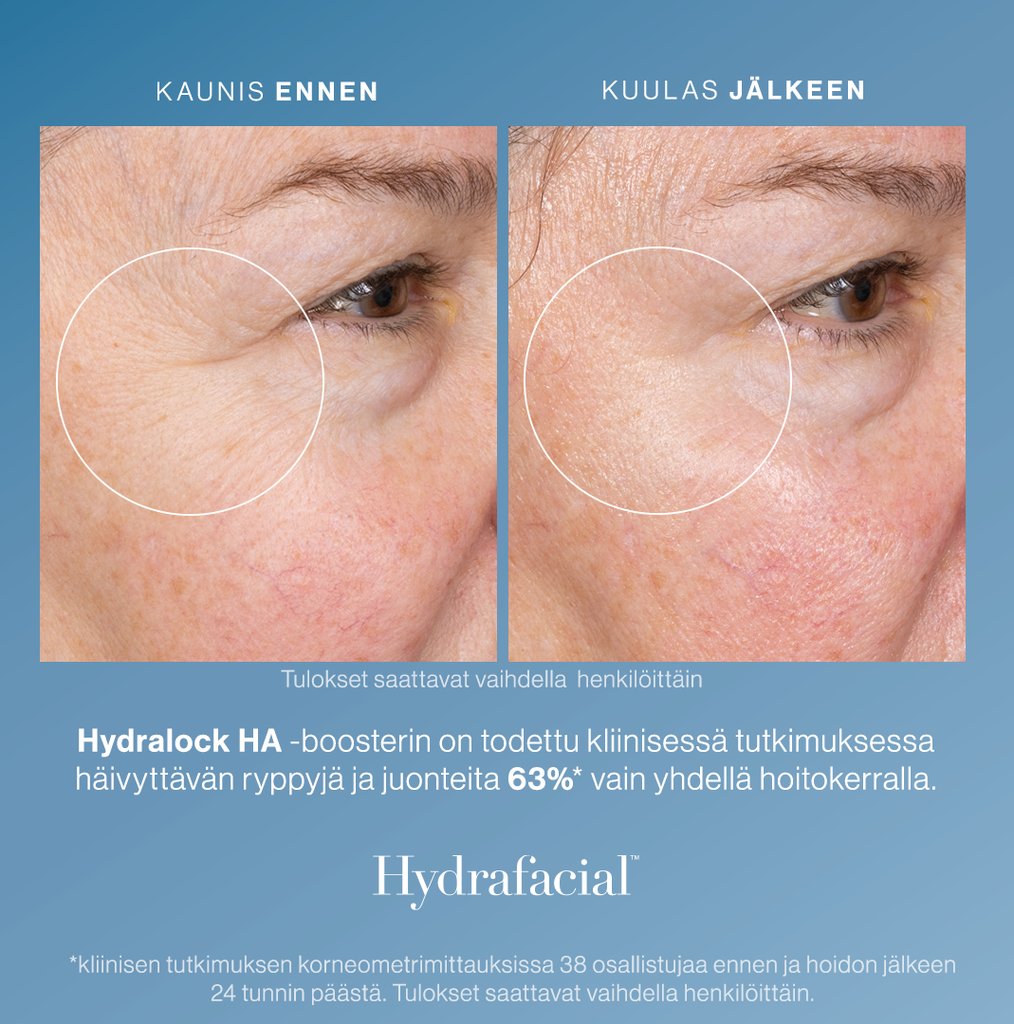 Hydrafacial Hydralock HA Booster - 6 ampullia/laatikko