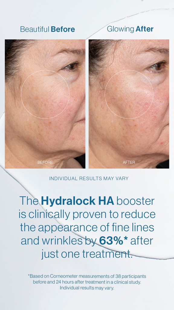Hydrafacial Hydralock HA Booster - 6 ampullia/laatikko