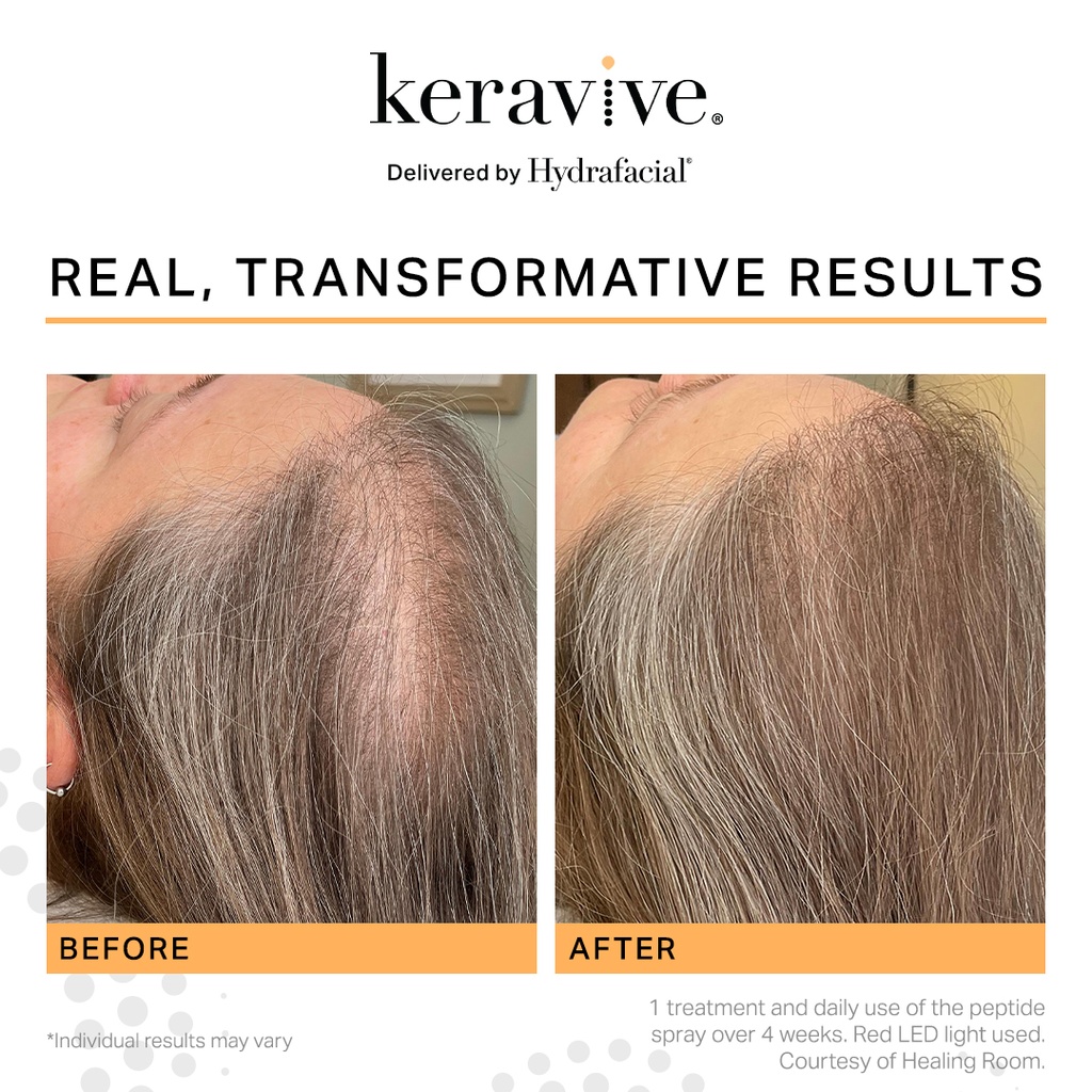 Hydrafacial Keravive Peptide Spray