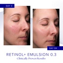 iS Clinical RETINOL+ EMULSION 0.3 30 g