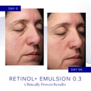 iS Clinical RETINOL+ EMULSION 0.3 30 g