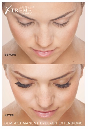Xtreme Lashes Professional Poster (24x36) - Before and After